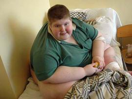 Самый толстый подросток России похудел на 95 кг