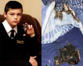 BlackBerry взорвался в кровати 11-летнего мальчика